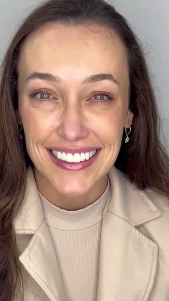 Sorriso de paciente da Nhovara
